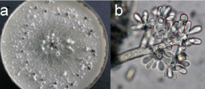 تصویر قارچ تولید کننده بیماری پوسیدگی ریشه آفتابگردان